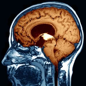X-ray image of human skeleton and brain 